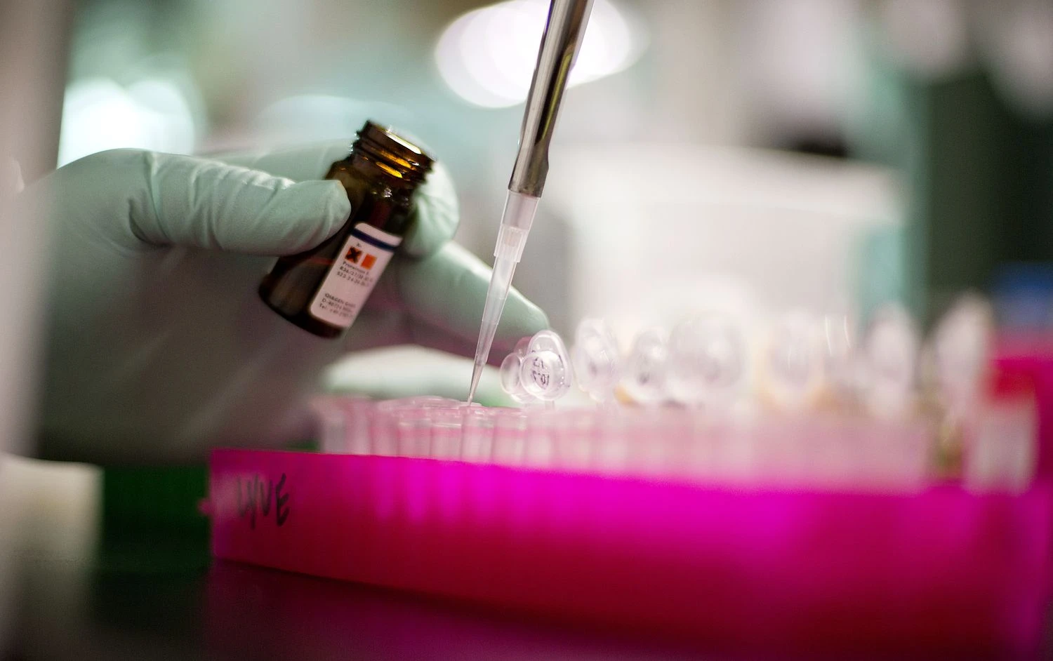 Ispanijos sveikatos ministerija apie listeriozės protrūkį informavo Pasaulio sveikatos organizaciją ir Europos Sąjungos institucijas. Davido Goldmano („AP Photo“/„Scanpix“) nuotr.