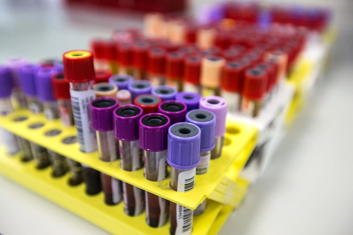 „Droplet Genomics“ bendrovės plėtojama technologija gali iš esmės pakeisti diagnostikos metodus, nes ji leidžia tirti mėginius po vieną ląstelę.  Juditos Grigelytės (VŽ) nuotr.