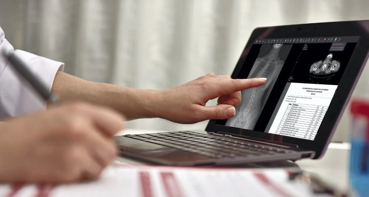 Nurse Hand Filling Medical History Patient and pointing on screen with X-ray scan