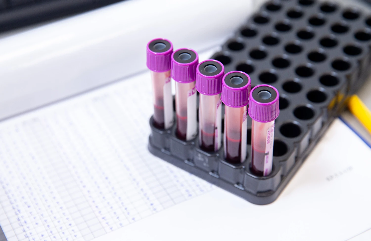 Juditos Grigelytės (VŽ) nuotr.