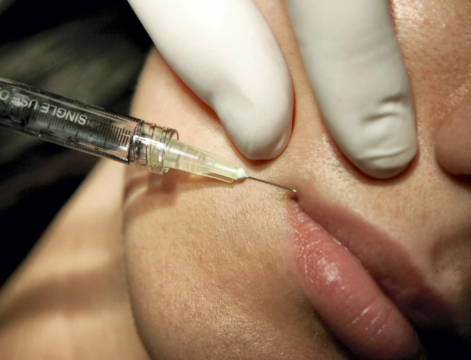 Pareigūnai išsiaiškino, kad direktorė grožio paslaugas, kurioms naudojamos adatos ir švirkštai, klientams teikė neturėdama tam reikiamų leidimų – gydytojo dermatovenerologo profesinės kvalifikacijos ir medicinos praktikos licencijos. Martyno Vidzbelio („Scanpix“) nuotr.