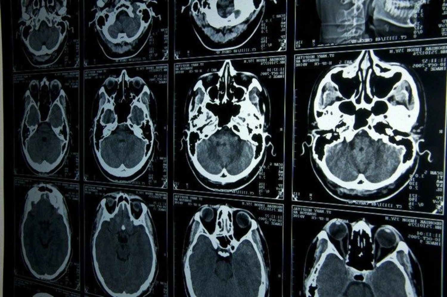 Lietuva pamažu atranda neurologijos metodų teikiamus pranašumus rinkodaroje. „Matton“ nuotr. 