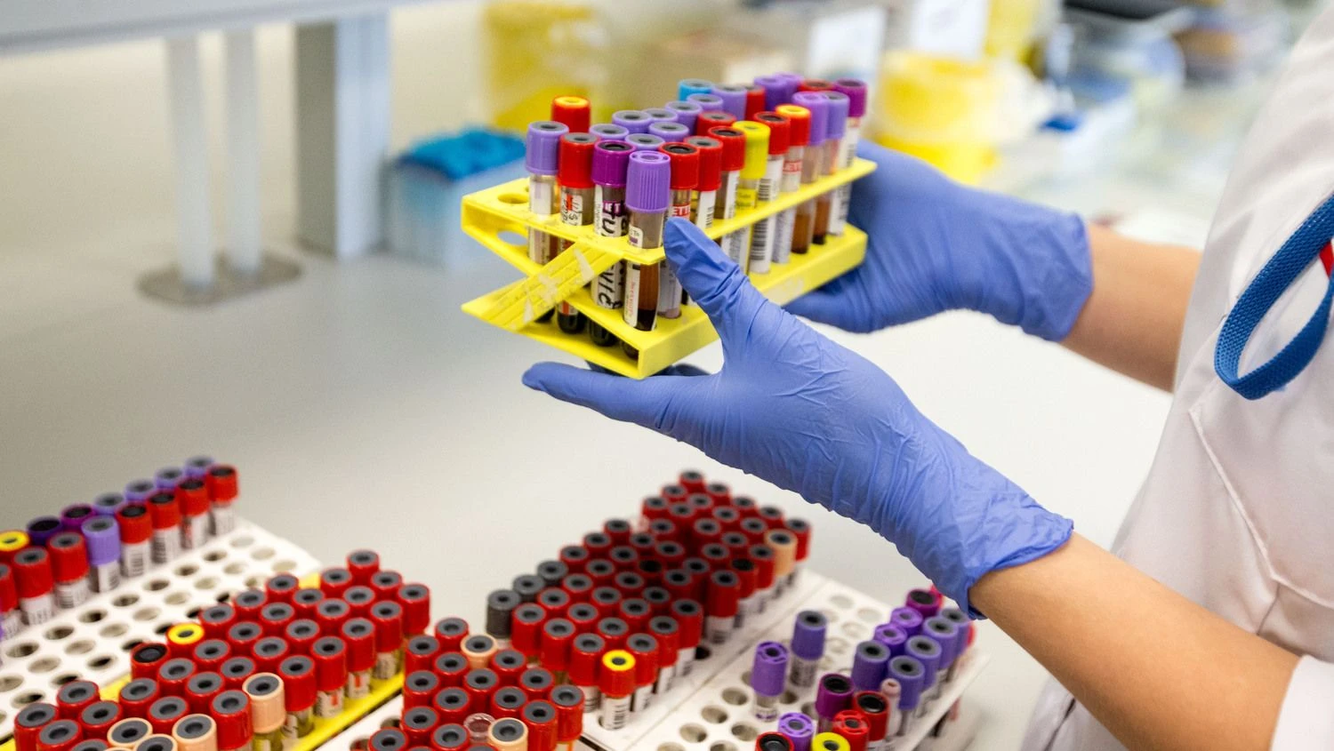 Tyrimo duomenimis, 2007 – 2016 m.medicinos įstaigos iš viso išleido 992,13 mln. Eur medicininei įrangai ir 275,4 mln. Eur – laboratorijų reikmenims įsigyti@CA foto autorius:Juditos Grigelytės nuotr.