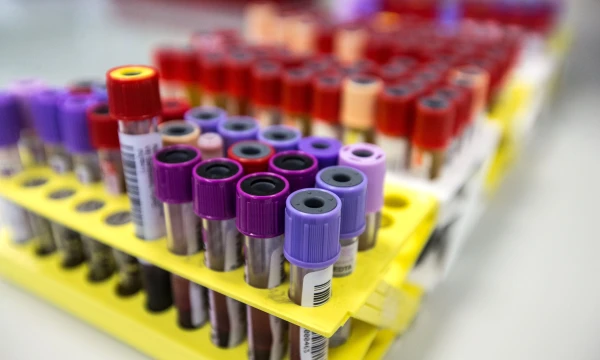 „Droplet Genomics“ bendrovės plėtojama technologija gali iš esmės pakeisti diagnostikos metodus, nes ji leidžia tirti mėginius po vieną ląstelę.  Juditos Grigelytės (VŽ) nuotr.