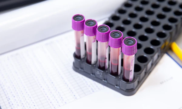 Juditos Grigelytės (VŽ) nuotr.