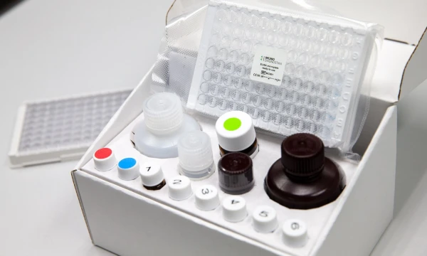 UAB „Imunodiagnostika“ laboratorijos. Kiekybinis COVID-19 antikūnių testas. Juditos Grigelytės (VŽ) nuotr.