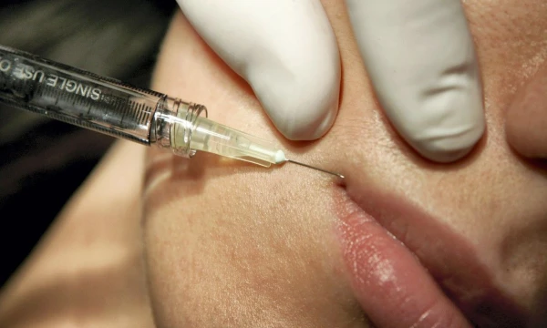 Pareigūnai išsiaiškino, kad direktorė grožio paslaugas, kurioms naudojamos adatos ir švirkštai, klientams teikė neturėdama tam reikiamų leidimų – gydytojo dermatovenerologo profesinės kvalifikacijos ir medicinos praktikos licencijos. Martyno Vidzbelio („Scanpix“) nuotr.