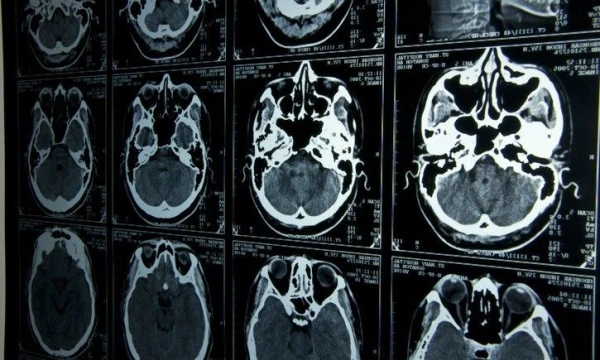 Lietuva pamažu atranda neurologijos metodų teikiamus pranašumus rinkodaroje. „Matton“ nuotr. 